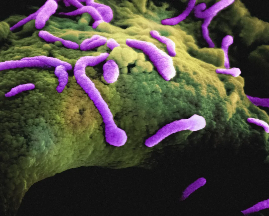 News photo illustrating: Cyclosporiasis Outbreak Spreads as Officials Search for Source